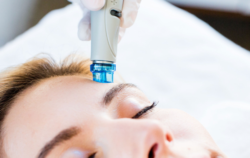5 Benefits of Getting a Hydrafacial in London