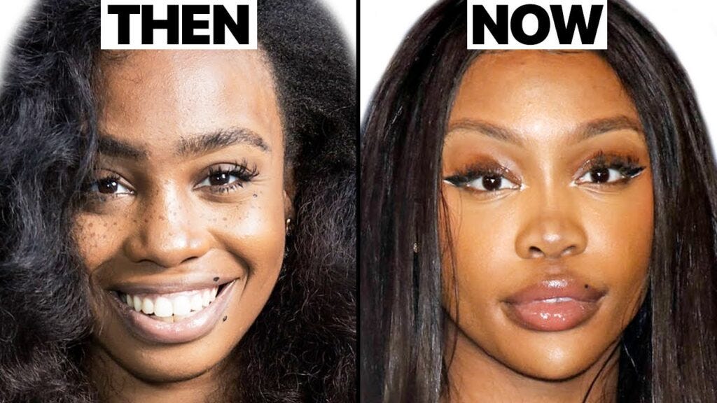 SZA Before Surgery